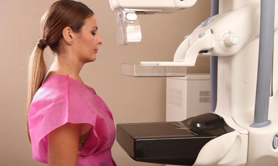 The Mammography Market Is Driven By Increasing Prevalence Of Breast Cancer