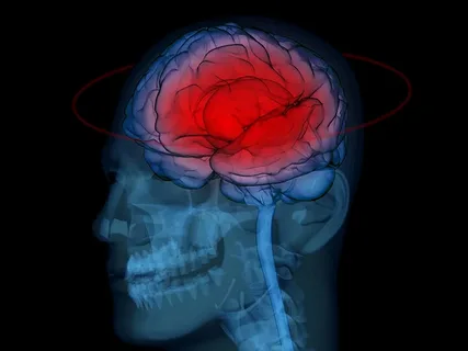 Using the Body’s Own Cells to Treat Traumatic Brain Injury