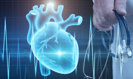Cardiology Electrodes
