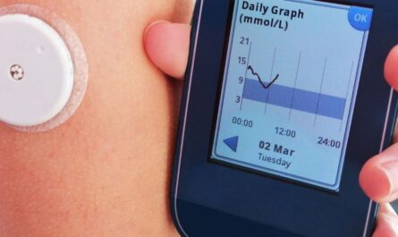 Diabetes Monitoring Devices Market