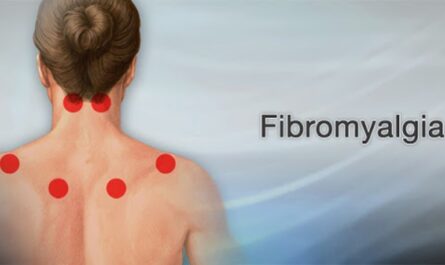Global Fibromyalgia Treatment Market