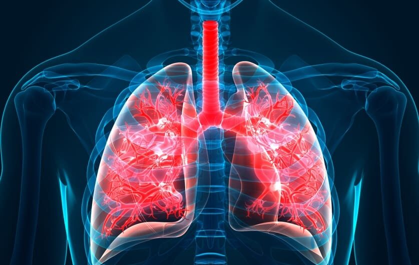 Idiopathic Pulmonary Fibrosis: An Overview