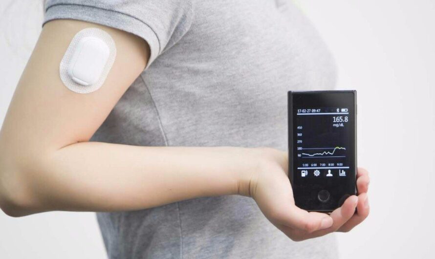 China Leads the Boom in Continuous Glucose Monitoring Devices