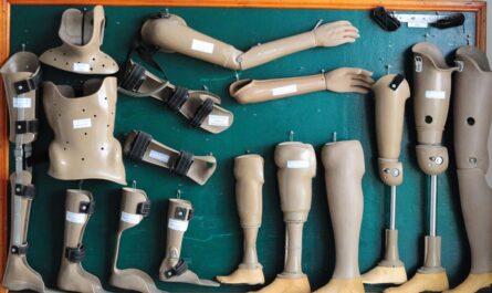 China Orthosis and Prosthetics Market